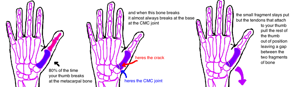What type of joint is found at the base of the thumb?